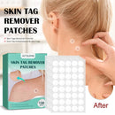 120-480pcs Skin Tag Remover Patch Wart Treatment Stickers Absorb Plaster Hydrocolloid Gel Anti-infection Invisible Skin Care