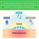 BREYLEE Acne Pimple Patch Stickers Acne Treatment Pimple Remover Tool Blemish Spot Facial Mask Skin Care Waterproof 22 Patches