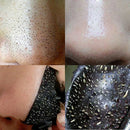 10 PCS Nose Blackhead Remover Mask Deep Cleansing Skin Care Shrink Pore Acne Treatment Mask Nose Black dots Pore Clean Strips