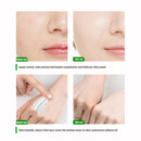 Body Whitening Cream Underarm Knee Buttocks Dark Skin Bleach Improve Melanin Pigmentation Dull Moisturizing Brighten Skin Care