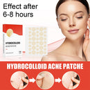 144pcs/set Face Men Women Skin Care Acne Pimple Patch 2 Sizes Invisible Professional Healing Absorbing Spot Sticker Covering