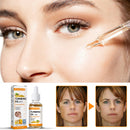Turmeric Whitening Freckles Serum Remove Dark Spots Melasma Brighten Lighten Melanin Improve Dull Anti-aging Face Skin Care 10ml