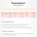 LANBENA Face Blackheads Remover Peel Off Black Dots Mask Skin Care Product Nose Pore Strips Stickers Acne Treatment Facial Masks