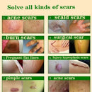 Acne Surgical Stretch Marks Removal Scar Cream Pimples Face Gel Child Acne Smoothening Whitening Body Skin Care Pigmentation