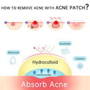 AUQUEST 72 Invisible Acne Pimple Patch Mask Skin Care Blemish Spot Concealer Remover Pimple Patches Stickers Masks Beauty Health
