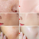 Lactobionic Acid Pore Shrink Face Serum Hyaluronic Acid Moisturizing Nourishing Essence Firming Brighten Beauty Korean Cosmetics