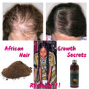 Africa Wild Rosemary Oil Crazy Hair Growth Traction Alopecia Chebe Powder Hair Loss Regrow your Edges Bald Spots Thinnin Hair