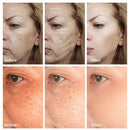 Freckle Removal Cream Whitening Cream Remove Dark Spots Melanin Melasma Pigmentation Anti-Aging Brighten Face Skin Care Cosmetic