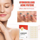 144pcs/set Face Men Women Skin Care Acne Pimple Patch 2 Sizes Invisible Professional Healing Absorbing Spot Sticker Covering