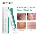 BREYLEE Scar Removal Cream Stretch Marks Removal Acne Scars Skin Repair Whitening Cream Dark Spot Remover For Face Skin Care