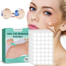 120-480pcs Skin Tag Remover Patch Wart Treatment Stickers Absorb Plaster Hydrocolloid Gel Anti-infection Invisible Skin Care
