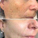 Turmeric Whitening Freckles Serum Remove Dark Spots Melasma Brighten Lighten Melanin Improve Dull Anti-aging Face Skin Care 10ml