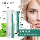 BREYLEE Scar Removal Cream Stretch Marks Removal Acne Scars Skin Repair Whitening Cream Dark Spot Remover For Face Skin Care