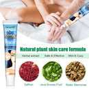 20g Herbal Extract Vitiligo Ointment Remove Ringworm White Spot Removal Skin White Spot Leukoplakia Disease Treatment Cream