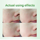 Hyaluronic Acid Moisturizing Serum Shrink Pores Oil Control Face Essence Whitening Brighten Wrinkle Remover Firming Products