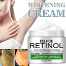 Women Body Whitening Cream Underarm Legs Knee Elbow Private Parts Brighten Armpit Whitening Cream Remove Dark Spots Skin Care