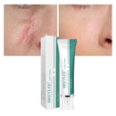 BREYLEE Scar Removal Cream Stretch Marks Removal Acne Scars Skin Repair Whitening Cream Dark Spot Remover For Face Skin Care