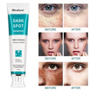 Whitening Freckle Cream Remove Melasma Cream Remove Dark Spots Melanin Melasma Remover Brighten Skin Anti-Aging Skin Lightening