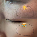 20g Effective Freckle Cream Remove Melasma Dark Spots Whitening Melanin Corrector Treat Acne Scars Brighten Lightening Cream