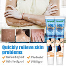 20g Herbal Extract Vitiligo Ointment Remove Ringworm White Spot Removal Skin White Spot Leukoplakia Disease Treatment Cream