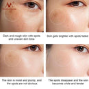 Powerful Whitening Freckle Cream Remove Acne Spots Melanin Dark Spots Face Lift Firming Face Skin Care Beauty Essentials