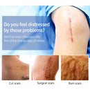 Scar Removal Cream Gel Remove Acne Spots Treatment Stretch Marks Burn Surgical Scar Repair Cream Smoothing Whitening Skin Beauty