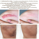 Acne Surgical Stretch Marks Removal Scar Cream Pimples Face Gel Child Acne Smoothening Whitening Body Skin Care Pigmentation