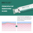 BREYLEE Scar Removal Cream Stretch Marks Removal Acne Scars Skin Repair Whitening Cream Dark Spot Remover For Face Skin Care