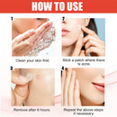 144pcs/set Face Men Women Skin Care Acne Pimple Patch 2 Sizes Invisible Professional Healing Absorbing Spot Sticker Covering