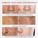20g Effective Freckle Cream Remove Melasma Dark Spots Whitening Melanin Corrector Treat Acne Scars Brighten Lightening Cream