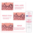 Freckle Removal Cream Whitening Cream Remove Dark Spots Melanin Melasma Pigmentation Anti-Aging Brighten Face Skin Care Cosmetic