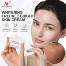 Powerful Whitening Freckle Cream Remove Acne Spots Melanin Dark Spots Face Lift Firming Face Skin Care Beauty Essentials