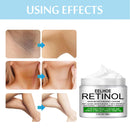 Body Whitening Cream Underarm Knee Buttocks Dark Skin Bleach Improve Melanin Pigmentation Dull Moisturizing Brighten Skin Care
