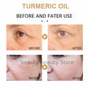 Turmeric Oil Skin To Lightening Acne Dark Patches Acne Bright Skin Dark Spot Corrector Anti Aging Face Whitening Serum Care