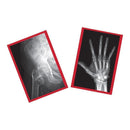 FIXED BONES X-RAYS-Arts & Crafts-JadeMoghul Inc.