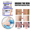 Effective Varicose Veins Relief Cream Relieve Vasculitis Phlebitis Spider Pain Treatment Ointment Medical Plaster Body Care 30g