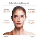 New Vitamin C Whitening Face Serum JoyPretty Hyaluronic Acid Facial Skin Spot Purifying Serum Dark Spot Remover Cosmetics