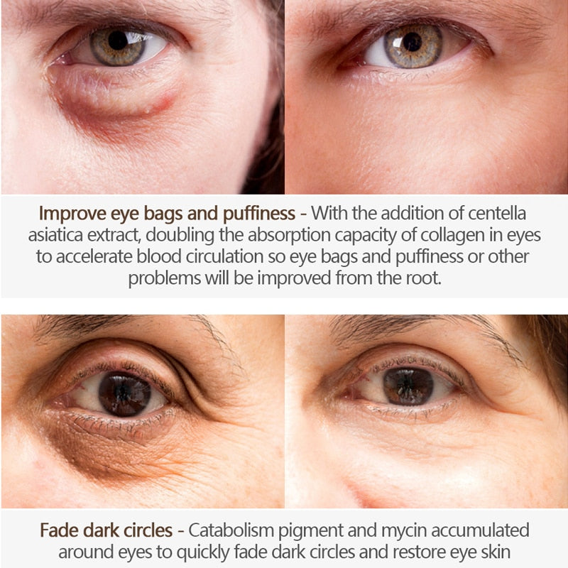 Crocodile Anti-Aging Eye Cream Remove Dark Circles Puffiness Lighten Fine Lines Whitening Moisturizing Eye Care