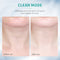 ANLAN Neck Face Beauty Device 3 Colors LED Photon Therapy Skin Tighten Reduce Double Chin Anti Wrinkle Remove Skin Care Tools