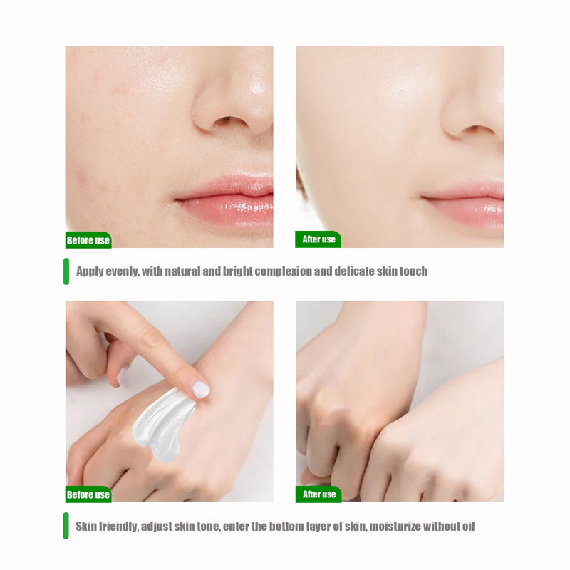 Body Whitening Cream Underarm Knee Buttocks Dark Skin Bleach Improve Melanin Pigmentation Dull Moisturizing Brighten Skin Care