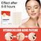 144pcs/set Face Men Women Skin Care Acne Pimple Patch 2 Sizes Invisible Professional Healing Absorbing Spot Sticker Covering
