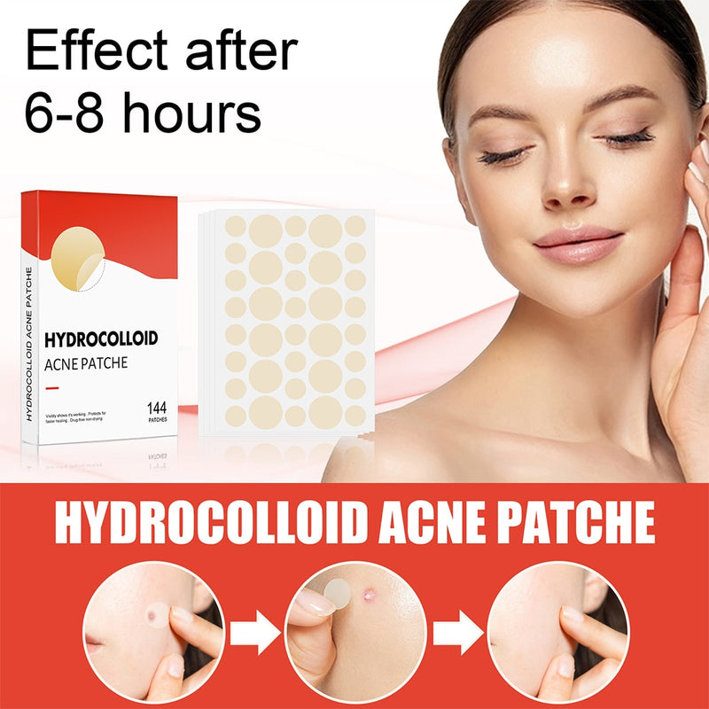 144pcs/set Face Men Women Skin Care Acne Pimple Patch 2 Sizes Invisible Professional Healing Absorbing Spot Sticker Covering