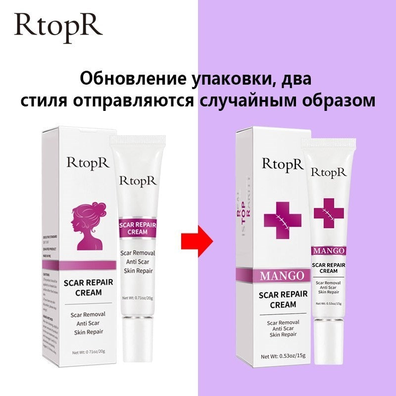 Skin Scar Removal Cream Face Fade Scars Cream Acne Spots Acne Treatment Blackhead Whitening Cream Anti Scar Stretch Marks Beauty