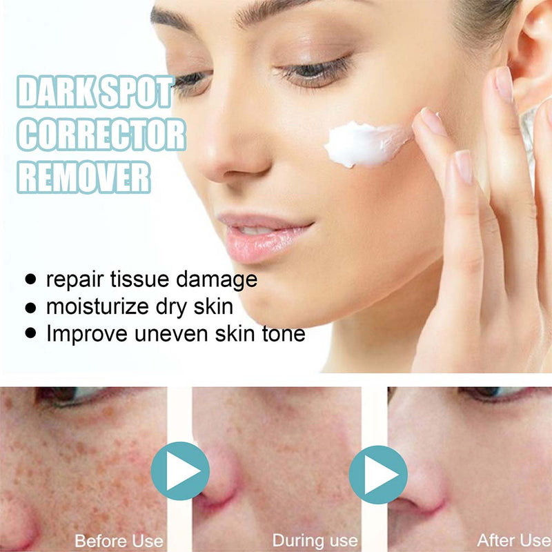 Nicotinamide Whitening Freckle Cream Dark Spot Remover Skin Care Products Moisturizing Brighten Pigment Correction Face Beauty