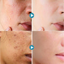 Hyaluronic Acid Moisturizing Serum Shrink Pores Oil Control Face Essence Whitening Brighten Wrinkle Remover Firming Products