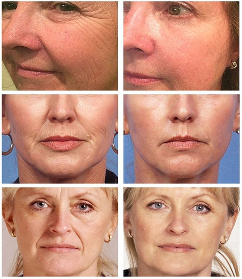 Instant Wrinkle Remover Face Serum Lift Firm Anti-aging Fade Fine Lines Moisturizing Essence Whitening Brighten Repair Skin Care
