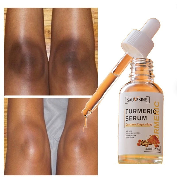 30ml Turmeric Serum Skin Glow To Lightening Acne Dark Patches, Acne Bright Dark Spot Corrector Face Whitening Serum Skin Care