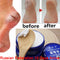 Traditional Chinese 33g Oil Anti-Drying Crack Foot Cream Heel Cracked Repair Cream Removal Dead Skin Hand Feet Care Foot Mask