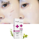 Skin Scar Removal Cream Face Fade Scars Cream Acne Spots Acne Treatment Blackhead Whitening Cream Anti Scar Stretch Marks Beauty