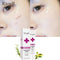 Skin Scar Removal Cream Face Fade Scars Cream Acne Spots Acne Treatment Blackhead Whitening Cream Anti Scar Stretch Marks Beauty
